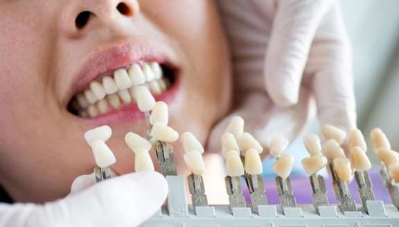 4 Things You Need to Know to Prep for Teeth Whitening