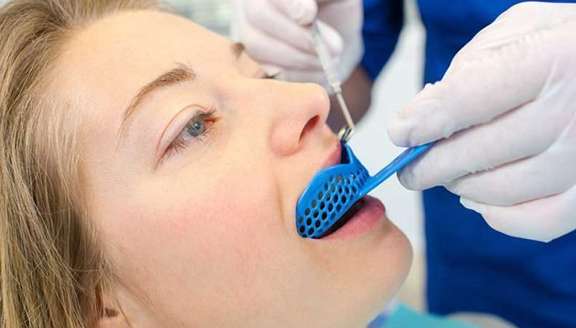 TMJ Disorder and Mouthguards
