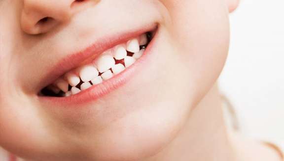 What is causing white spots and discoloration on my baby’s teeth?