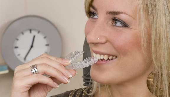 Invisalign FAQs