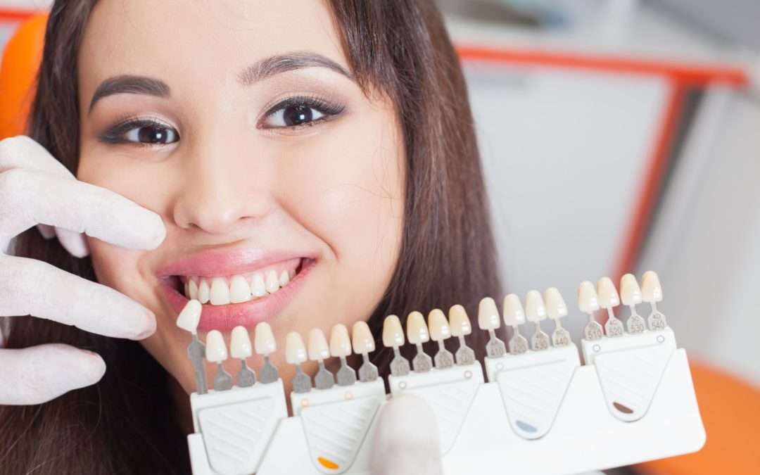 The Benefits of Dental Implant Surgery for Tooth Replacement