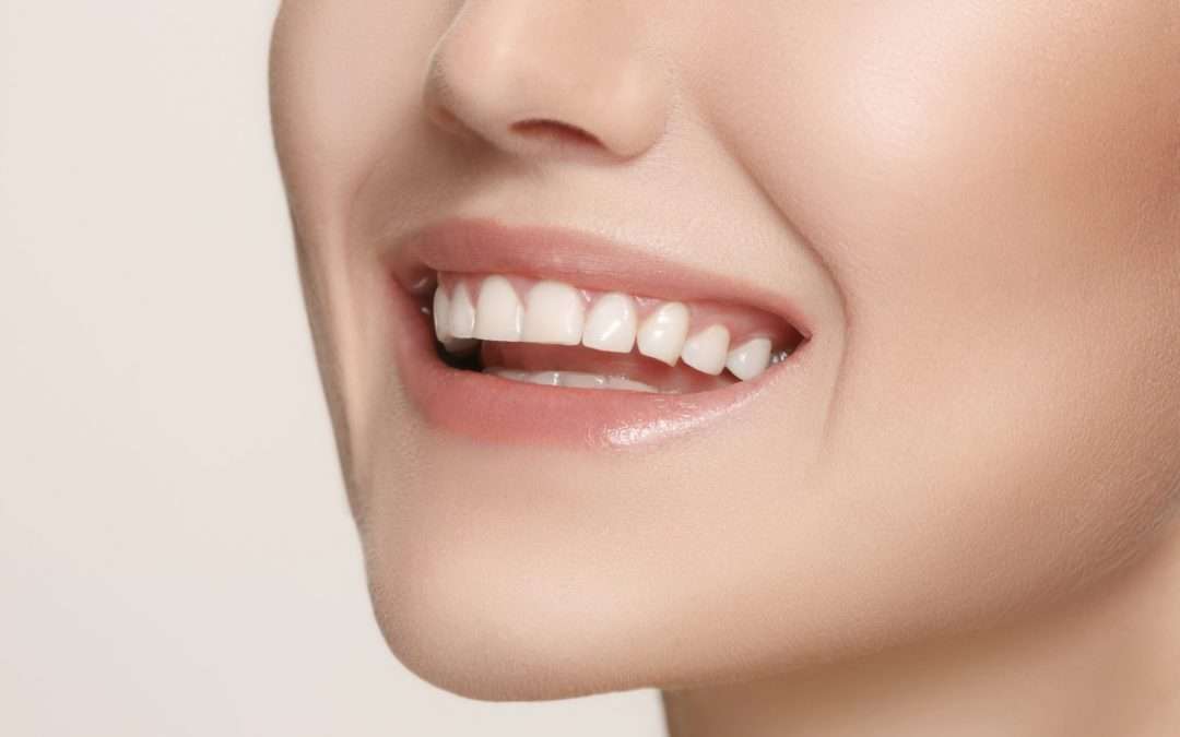 Don’t Let Missing Teeth Get in the Way Of Your Most Confident Smile