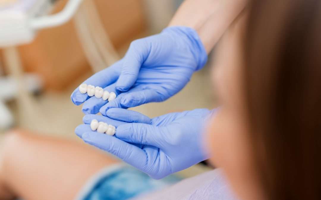The Basics & Benefits of Dental Bridges