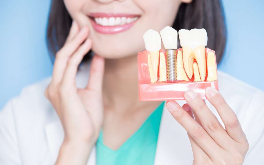 Reclaim a Gorgeous Smile: The Benefits of Dental Implants