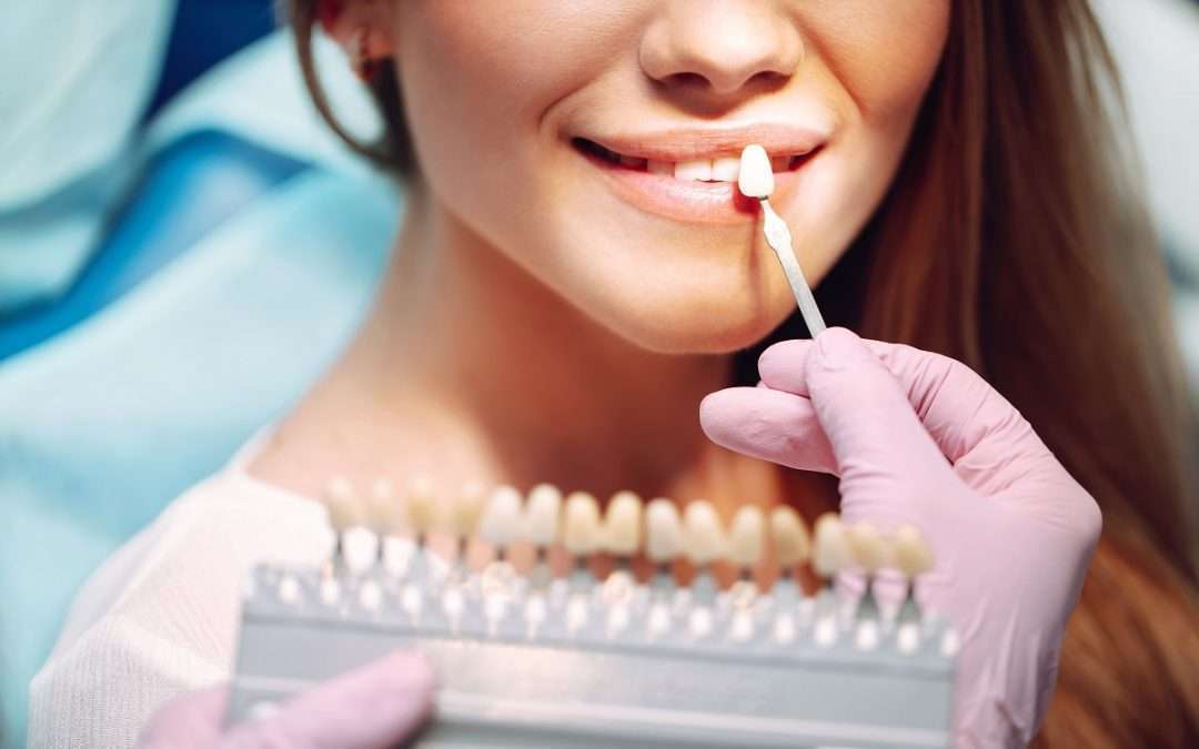 New and Improved Teeth Whitening Guide