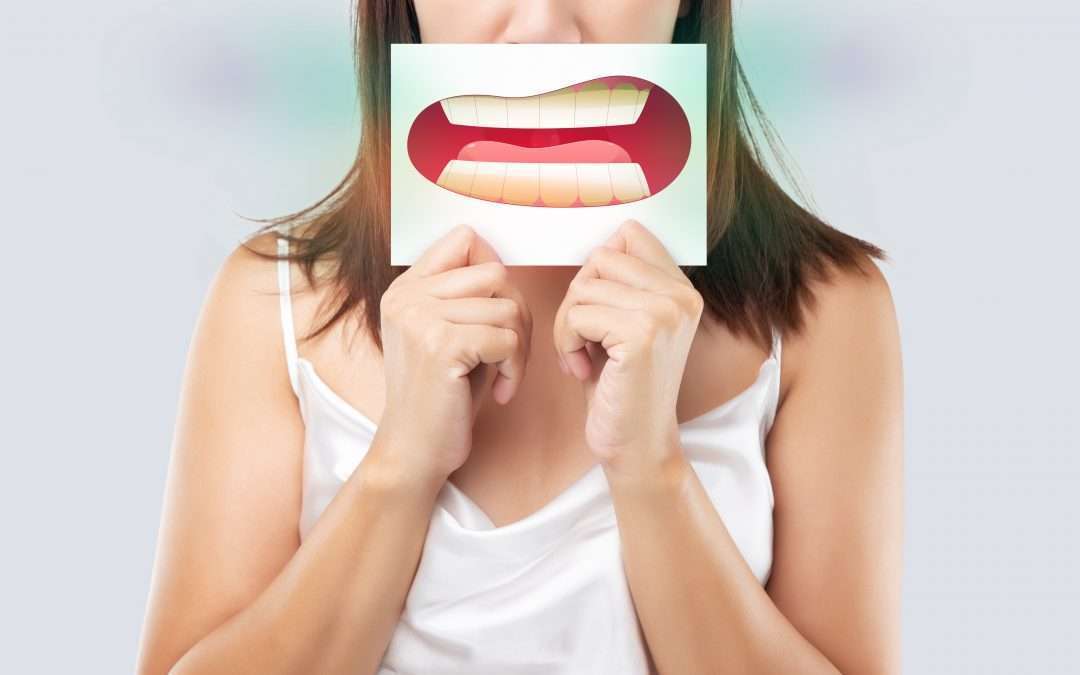 What Is Plaque and Why Does It Cause Gingivitis?