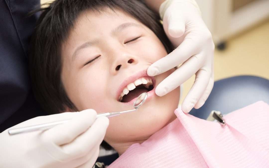 How Can I Prevent Plaque Build-Up?