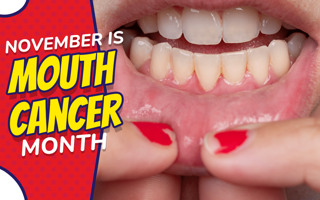 November Is Mouth Cancer Awareness Month: Learn the Facts From a McAllen Dentist