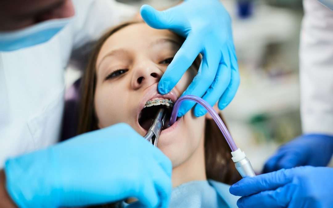 Can Braces Damage Your Teeth? 13 Ways to Take Care of Your Braces!