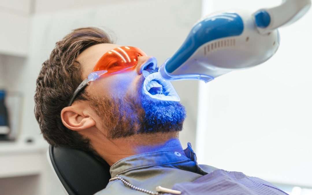 How To Prepare for Teeth Whitening: What To Do Before and After Teeth Whitening